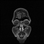 My Brain. Brain MRI Pictures.