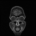 My Brain. Brain MRI Pictures.