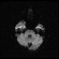 My Brain. Brain MRI Pictures.