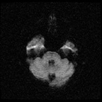 My Brain. Brain MRI Pictures.