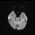 My Brain. Brain MRI Pictures.