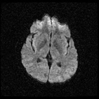 My Brain. Brain MRI Pictures.