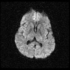 My Brain. Brain MRI Pictures.