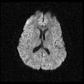 My Brain. Brain MRI Pictures.