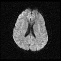 My Brain. Brain MRI Pictures.