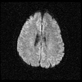 My Brain. Brain MRI Pictures.