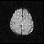 My Brain. Brain MRI Pictures.