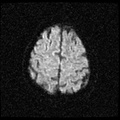 My Brain. Brain MRI Pictures.