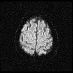 My Brain. Brain MRI Pictures.