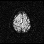 My Brain. Brain MRI Pictures.