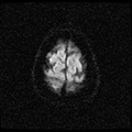 My Brain. Brain MRI Pictures.