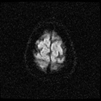 My Brain. Brain MRI Pictures.