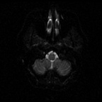 My Brain. Brain MRI Pictures.