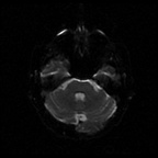 My Brain. Brain MRI Pictures.