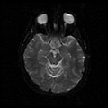 My Brain. Brain MRI Pictures.