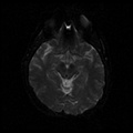 My Brain. Brain MRI Pictures.