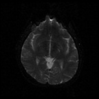 My Brain. Brain MRI Pictures.