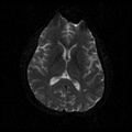 My Brain. Brain MRI Pictures.