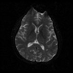 My Brain. Brain MRI Pictures.