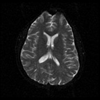 My Brain. Brain MRI Pictures.