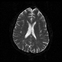 My Brain. Brain MRI Pictures.