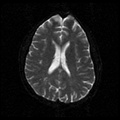 My Brain. Brain MRI Pictures.