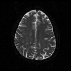 My Brain. Brain MRI Pictures.