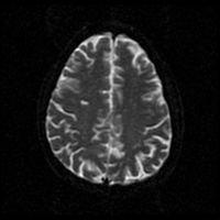 My Brain. Brain MRI Pictures.