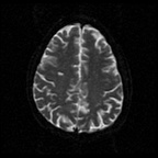 My Brain. Brain MRI Pictures.