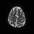 My Brain. Brain MRI Pictures.