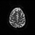 My Brain. Brain MRI Pictures.