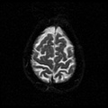 My Brain. Brain MRI Pictures.