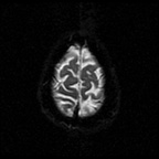 My Brain. Brain MRI Pictures.