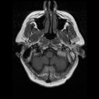 My Brain. Brain MRI Pictures.