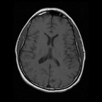 My Brain. Brain MRI Pictures.