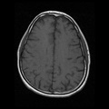 My Brain. Brain MRI Pictures.