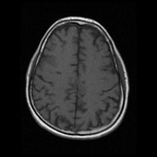 My Brain. Brain MRI Pictures.