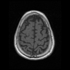 My Brain. Brain MRI Pictures.