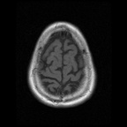 My Brain. Brain MRI Pictures.