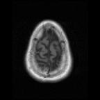 My Brain. Brain MRI Pictures.