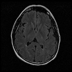 My Brain. Brain MRI Pictures.