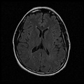 My Brain. Brain MRI Pictures.