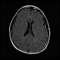 My Brain. Brain MRI Pictures.