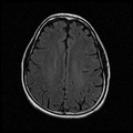 My Brain. Brain MRI Pictures.