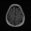 My Brain. Brain MRI Pictures.