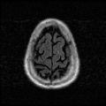 My Brain. Brain MRI Pictures.