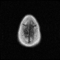 My Brain. Brain MRI Pictures.