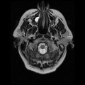 My Brain. Brain MRI Pictures.