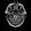 My Brain. Brain MRI Pictures.