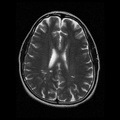 My Brain. Brain MRI Pictures.